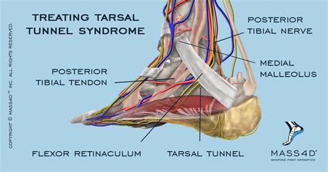 tibial nerve compression test|tibial nerve entrapment sites.